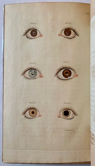 Item #22716 A Synopsis of the Diseases of the Eye, and Their Treatment (With 3 Hand-Colored Plates). Benjamin Travers.